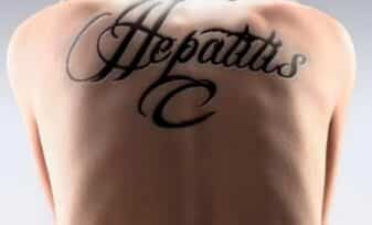 VIH y Hepatitis