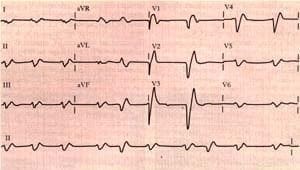 Secciones: Electrocardiograma