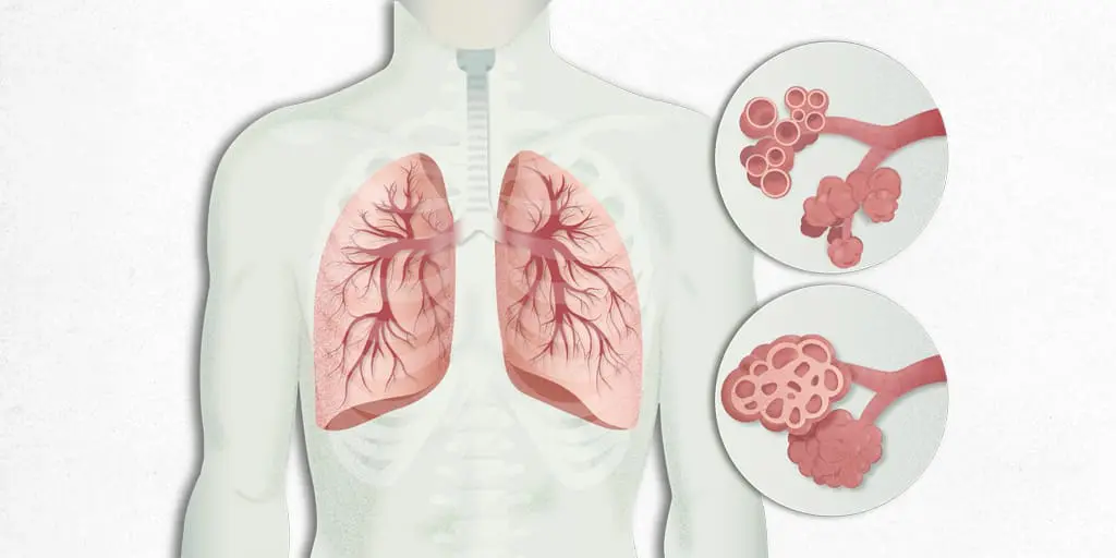 Biopsia quirúrgica enfermedad infiltrativa difusa del pulmon