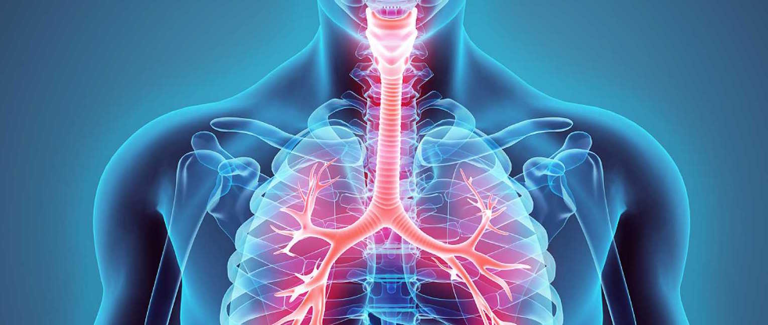 Linfangioleiomiomatosis pulmonar