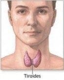 Tiroiditis Crónica