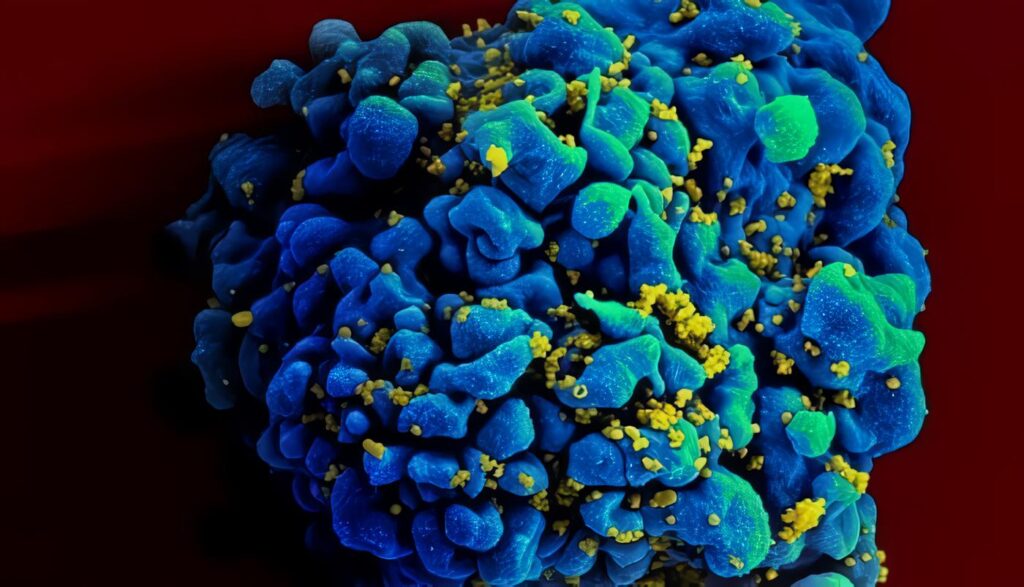 Activación Molecular: Procedimiento