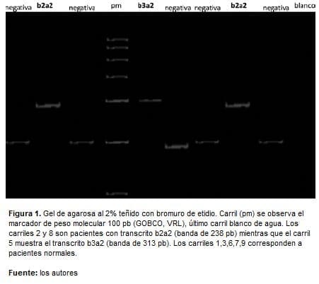 RNAm extraído de leucocitos