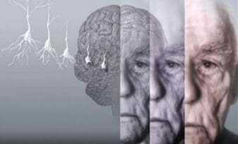 guía de alzheimer