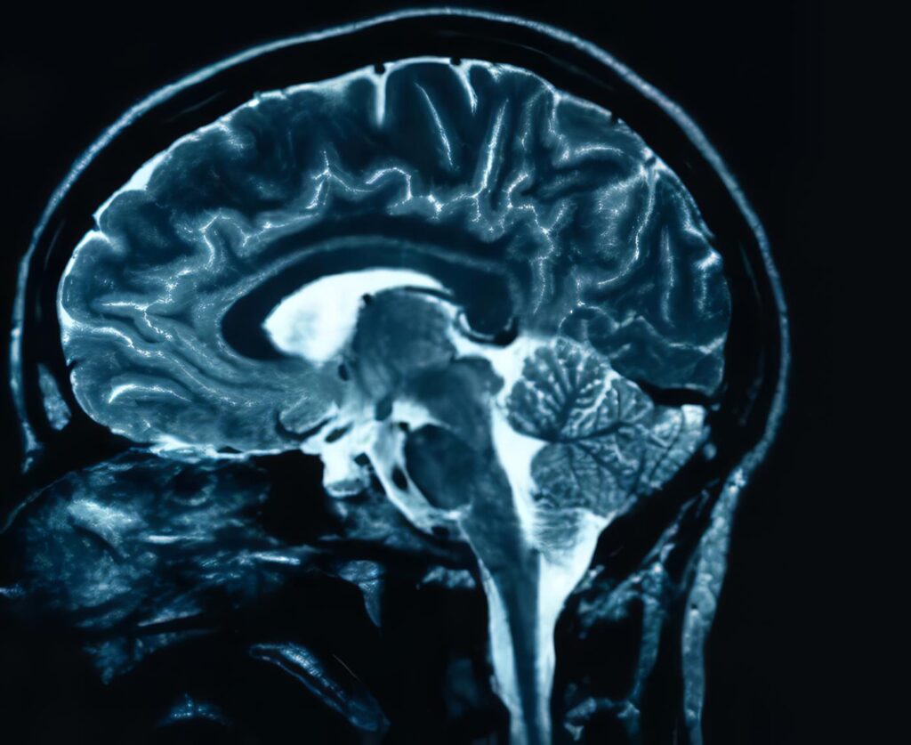 Cartas al Editor: Sobre Neuronatomía, Neurohistología e Historia