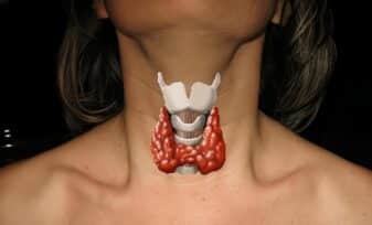 Tiroiditis Crónica