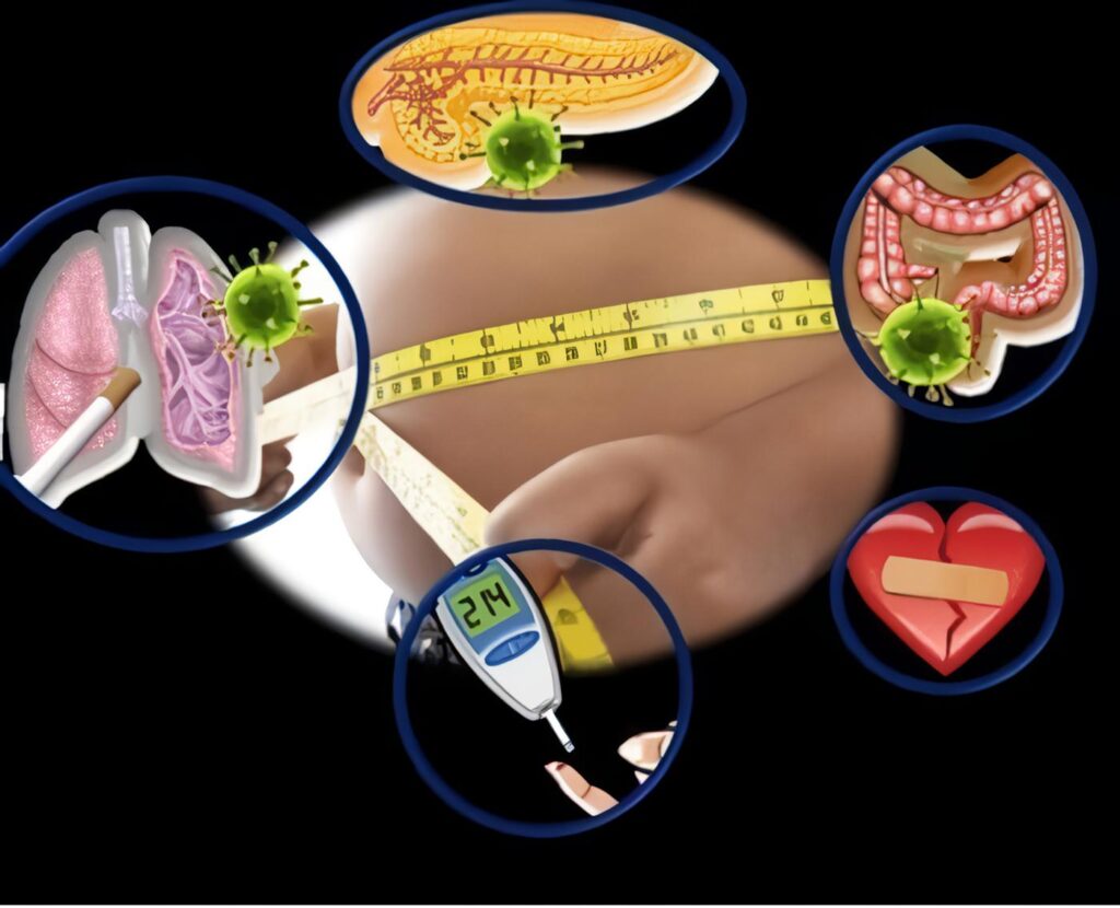 Nutrición: Enfermedades no Transmisibles Relacionadas con la Nutrición