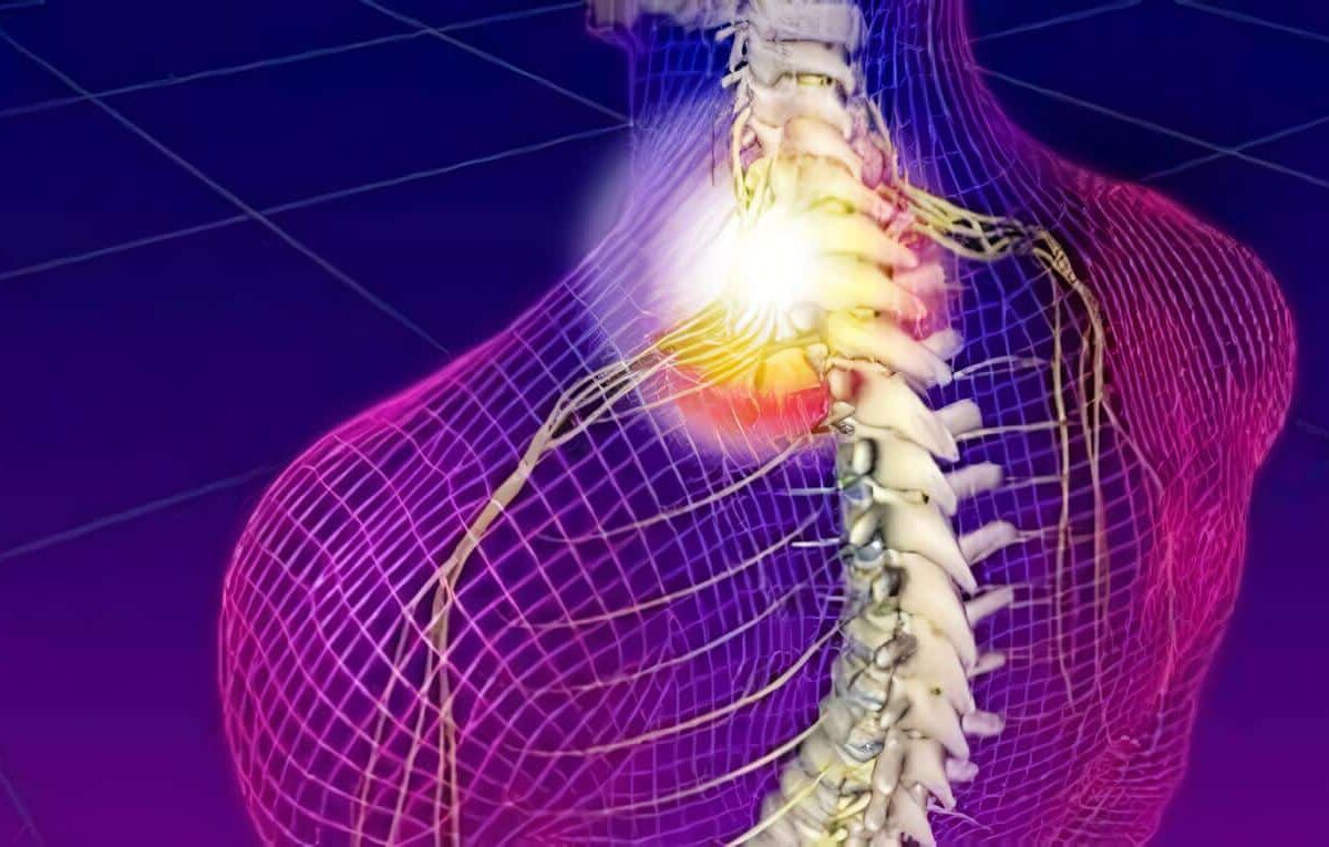 Trauma Raquimedular