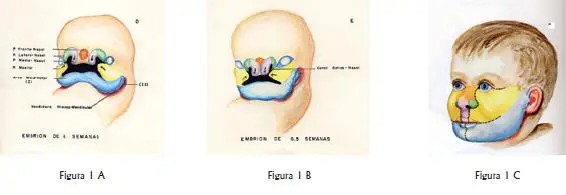 Proceso fronto nasal