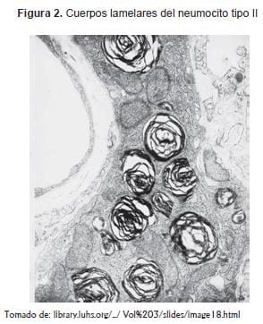 Cuerpos lamelares del neumocito