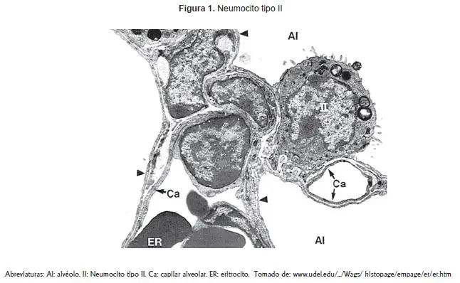 Neumocito tipo II