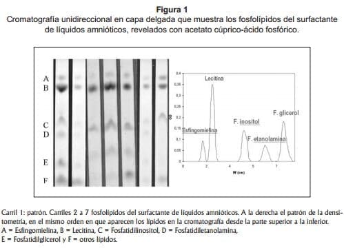 Liquido amniótico maduración pulmonar fetal