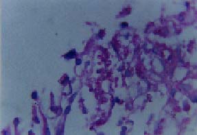 Presencia de microconidias de H. capsulatum