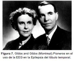 Uso de la EEG en la Epilepsia Uso de la EEG en la Epilepsia