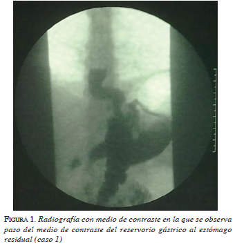 figura1-radiografia