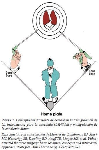 figura3-diamante-de-beisbol