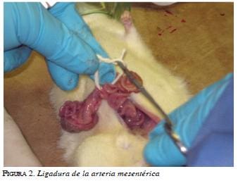 Ligadura de la arteria mesenterica