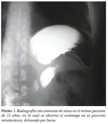 figura3-radiografia-torax