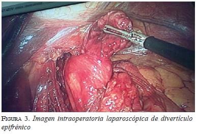figura3imagen-intraoperatoria
