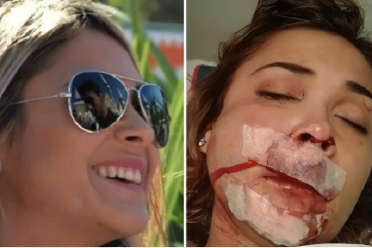 Agresion de animal con rabia