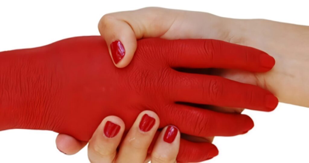 Artículo de Investigación: Genética Molecular de la Hemofilia A