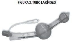 Tubo laríngeo