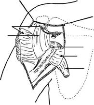 Tendón conjunto de los músculos coracobíceps