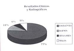 Resultados Clínicos y radiologicos displasia de Cadera