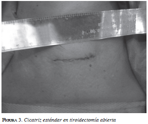 Cicatriz estándar en tiroidectomía abierta