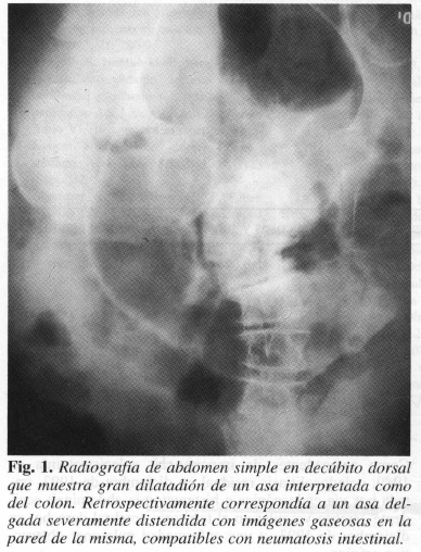 Radiografía de abdomen simple en decúbito dorsal