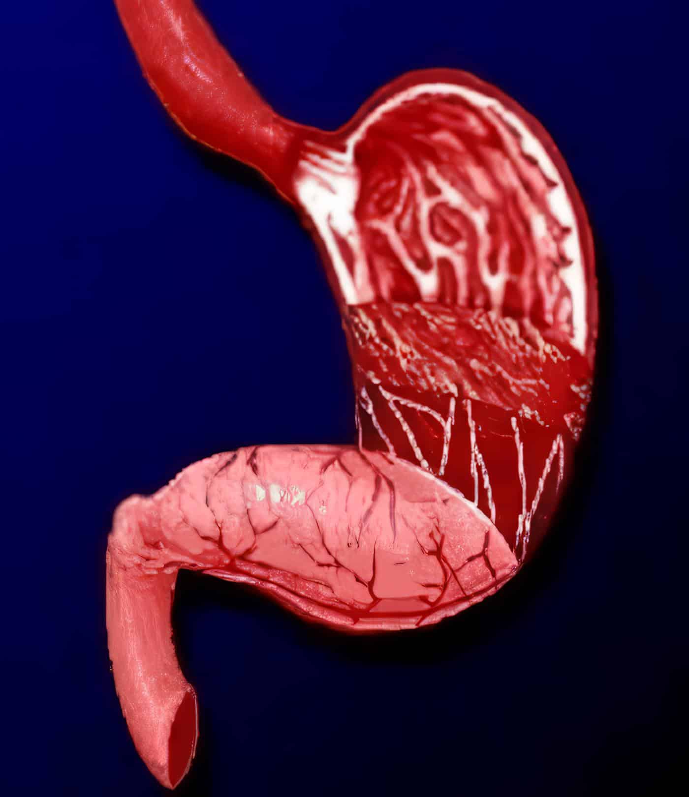 Gérmenes de la Sepsis Abdominal