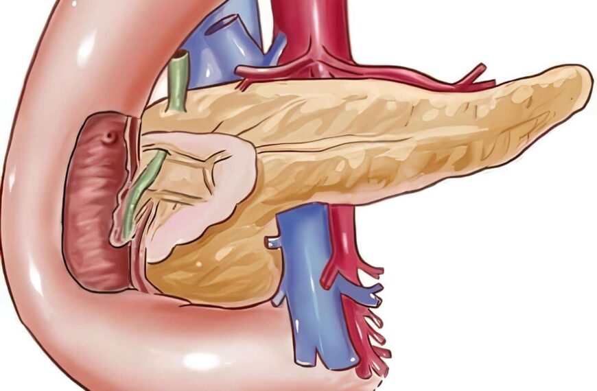 Tratamiento del Insulinoma