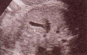 Abdomen Fetal, Estómago y vesícula biliar