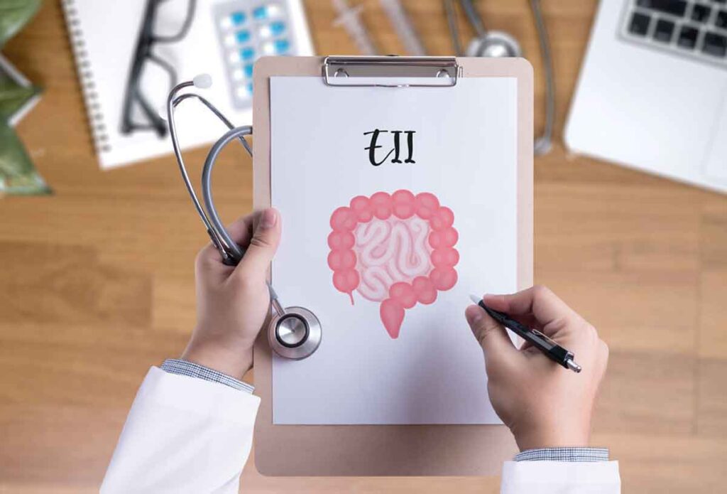 Retirar lácteos de la dieta en los brotes de actividad de la enfermedad inflamatoria intestinal EII