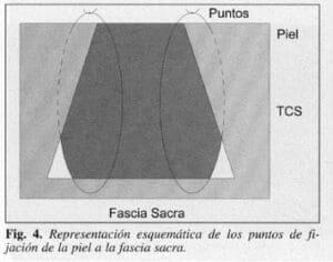 Puntos de fijación de la piel a la fascia sacra