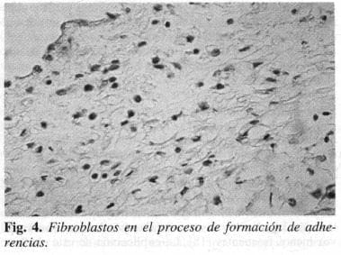 Fibroblastos en el proceso de formación de adherencias