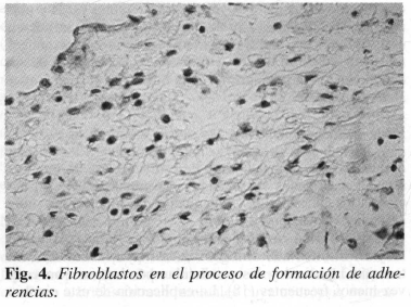 Fibroblastos en el proceso de formación de adherencias