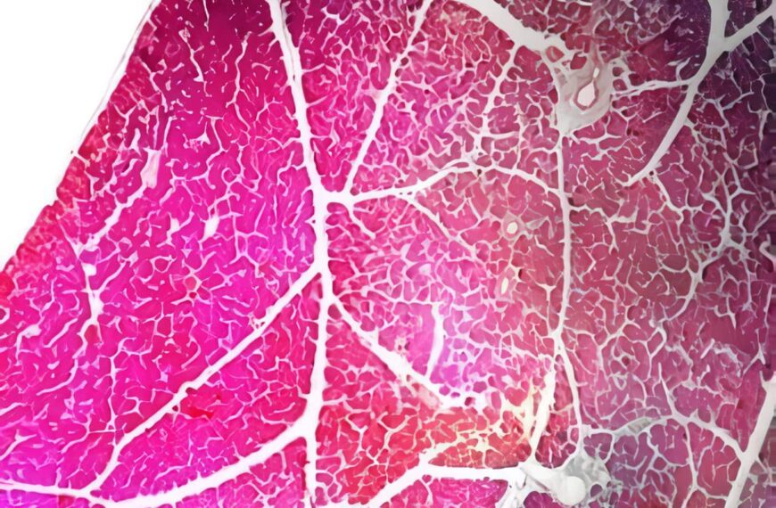 Insulinoma: Experiencia con 8 Casos Operados y Revisión del Tema