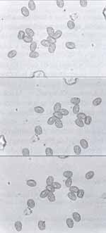 Imagen miscroscópica del polen de Cecropia peltata