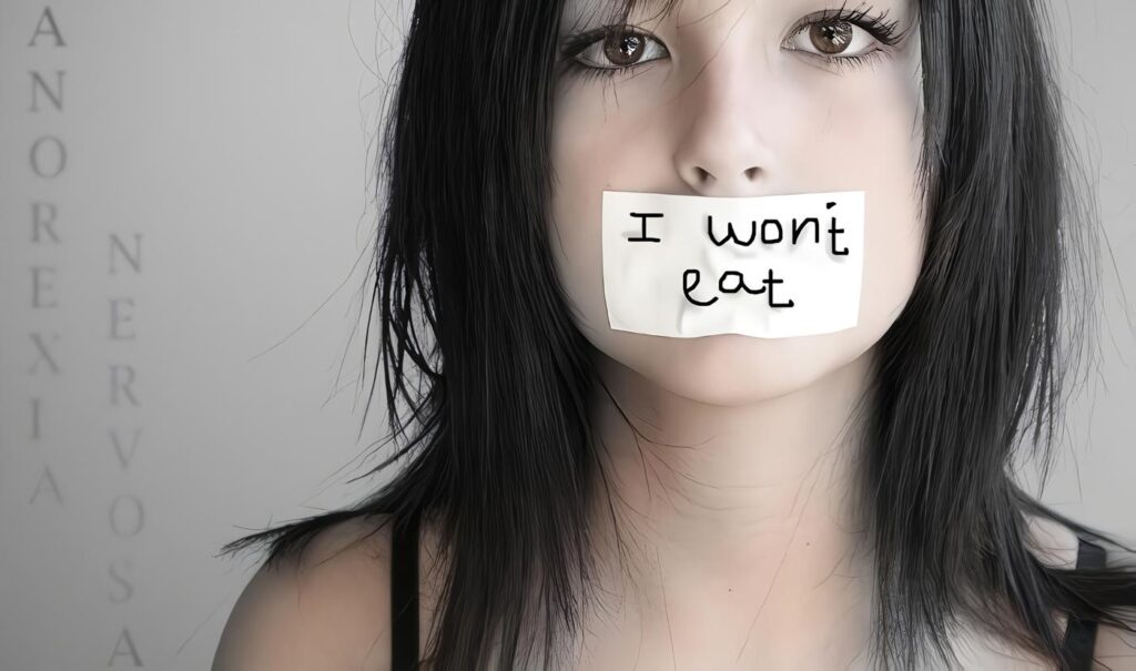 Anorexia – Caquexia