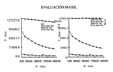 Actividad Mucociliar Evaluación Maxil