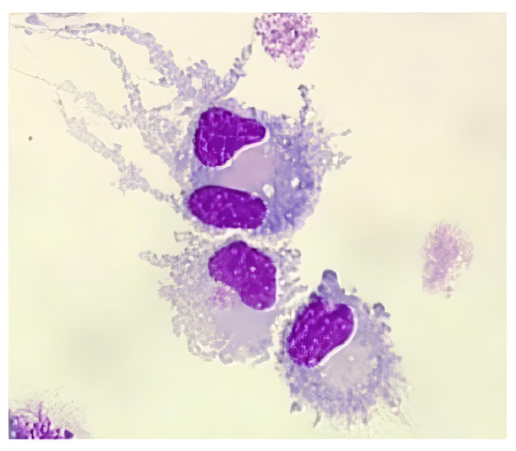 Inmuno Patogénesis de la Diabetes 1, Células Dendríticas