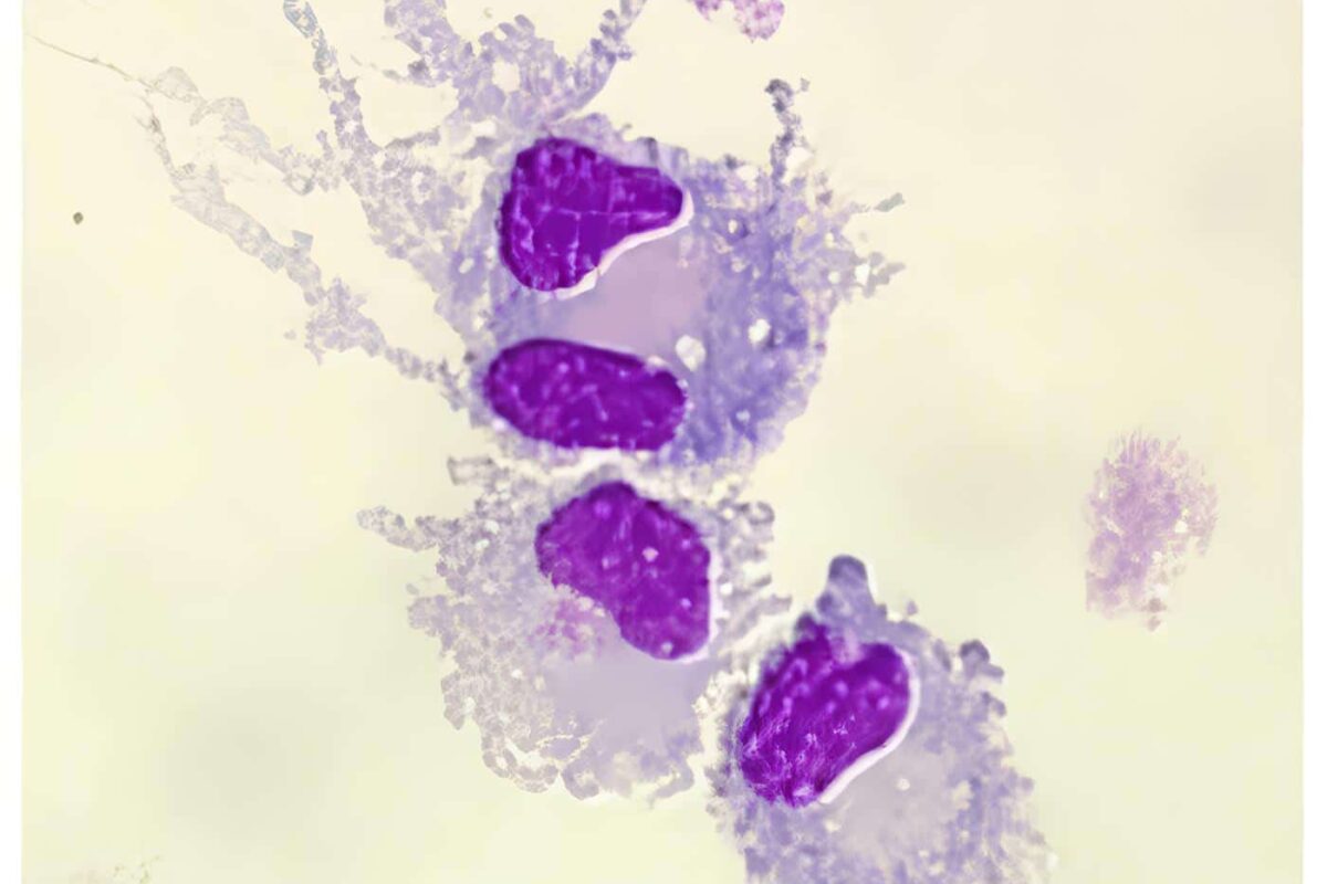 Células Dendríticas