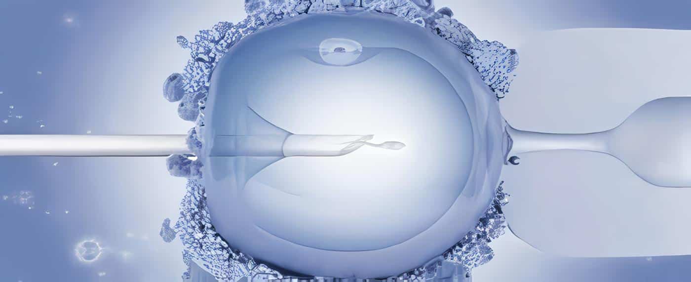 Inyeccion Intracitoplasmatica con Espermatozoides Testiculares Criopreservados en un Paciente con Azoospermia no Obstructiva