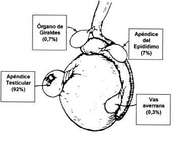 dolor-testicular-ampliando-el-espectro-urolog-a-colombiana-medicina