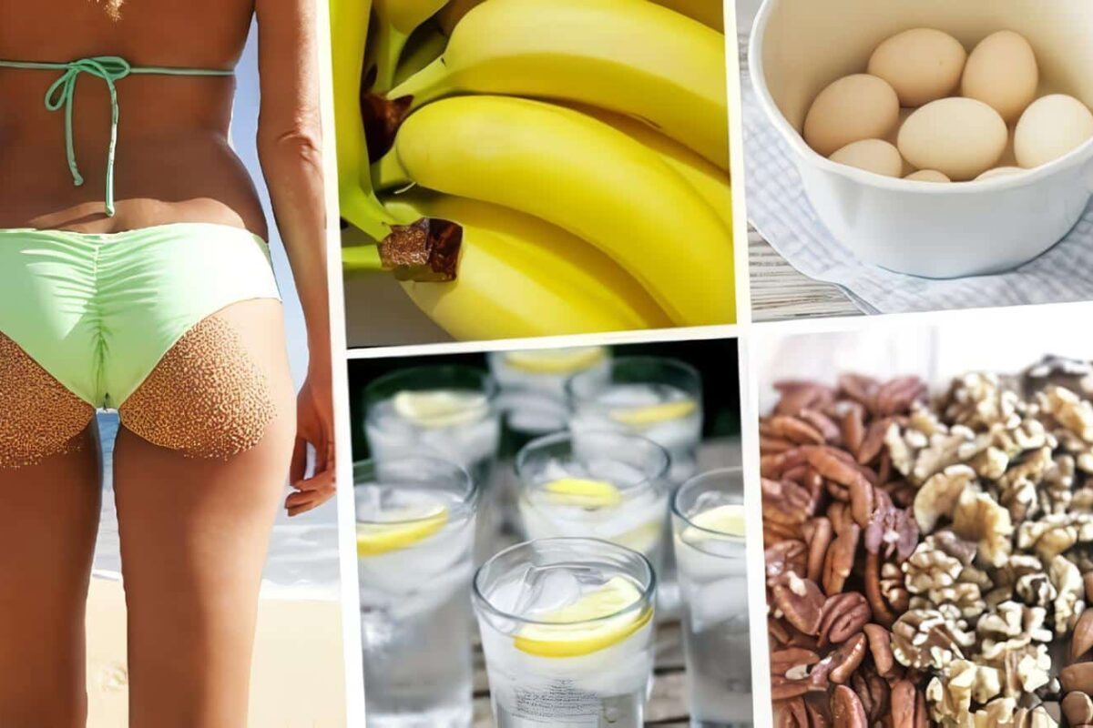 Prevenir la Celulitis