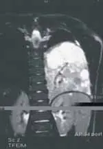 Tomografia corte transversal y corte coronal