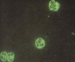 Inmunofluorescencia indirecta utilizando neutrófilos como sustrato