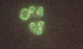  Inmunofluorescencia indirecta utilizando neutrófilos como sustrato.