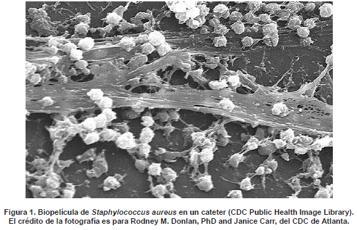 Biopelícula de Staphylococcus aureus en un cateter